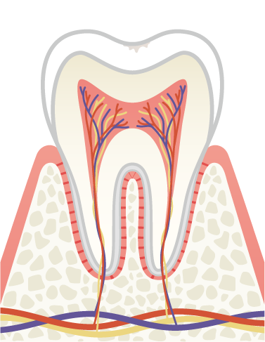 岩手県盛岡市の歯医者・インプラント歯科「高橋衛歯科医院」|C0 初期虫歯のイメージ