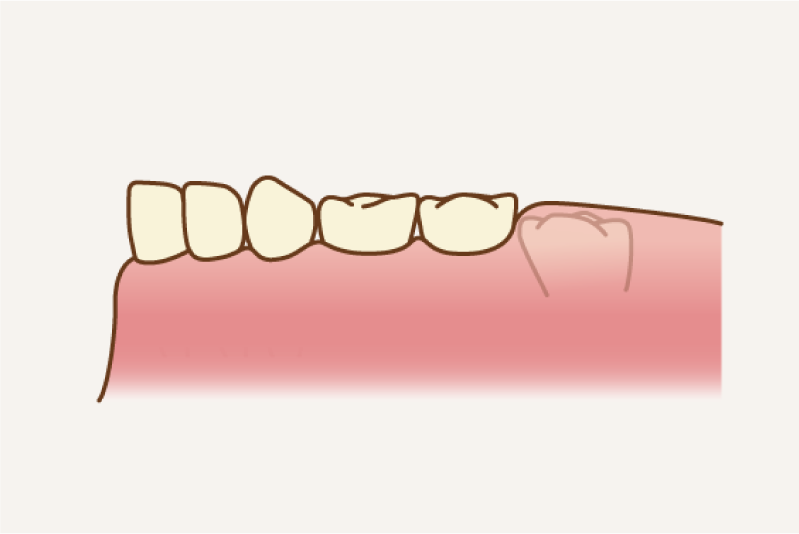 岩手県盛岡市の歯医者・インプラント歯科「高橋衛歯科医院」|アイコン01