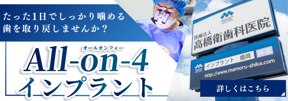 岩手県盛岡市の歯医者・インプラント歯科「高橋衛歯科医院」|たった1日でしっかり噛める歯を取り戻しませんか? ALL-On-4インプラント