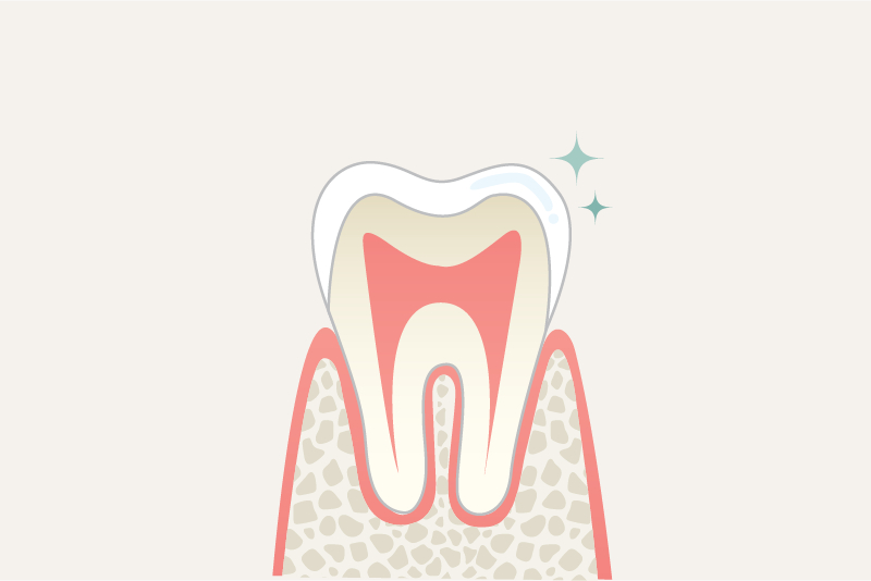 岩手県盛岡市の歯医者・インプラント歯科「高橋衛歯科医院」|自費のジルコニアクラウンの汚れの付着イメージ