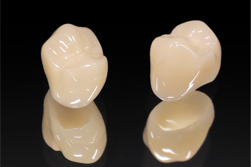 岩手県盛岡市の歯医者・インプラント歯科「高橋衛歯科医院」|自費は患者様の歯の色に合わせられる