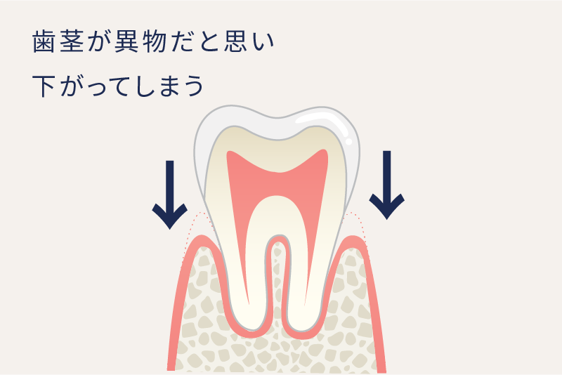 岩手県盛岡市の歯医者・インプラント歯科「高橋衛歯科医院」|保険の白い被せ物の生体親和性イメージ