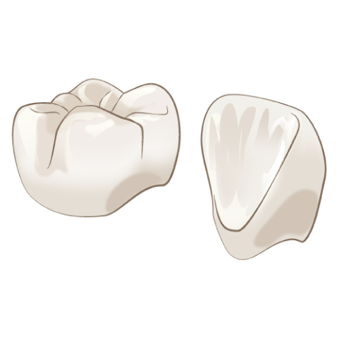 岩手県盛岡市の歯医者・インプラント歯科「高橋衛歯科医院」|ジルコニアインレー/クラウン