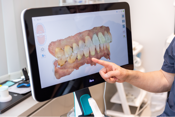 岩手県盛岡市の歯医者・インプラント歯科「高橋衛歯科医院」|口腔内スキャナーで簡易診断するところ