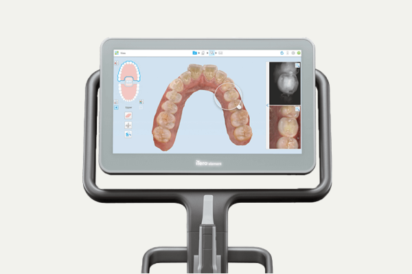 岩手県盛岡市の歯医者・インプラント歯科「高橋衛歯科医院」|口腔内スキャナーの機器