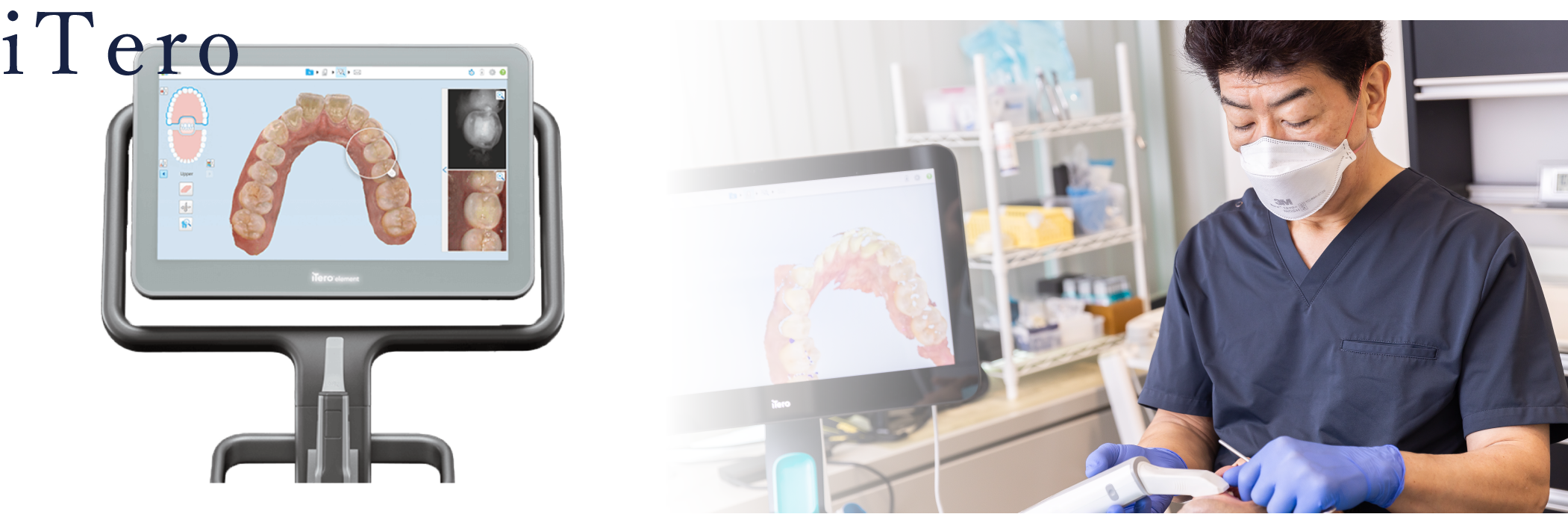 岩手県盛岡市の歯医者・インプラント歯科「高橋衛歯科医院」|iTeroを使ってお口の中をスキャンする様子