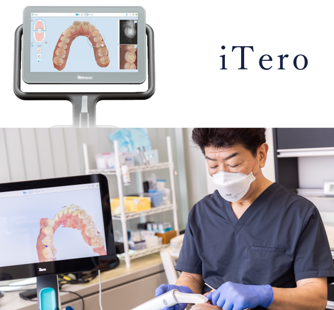 岩手県盛岡市の歯医者・インプラント歯科「高橋衛歯科医院」|iTeroを使ってお口の中をスキャンする様子