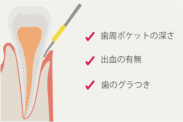 岩手県盛岡市の歯医者・インプラント歯科「高橋衛歯科医院」|Step02