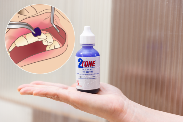 岩手県盛岡市の歯医者・インプラント歯科「高橋衛歯科医院」|Step03