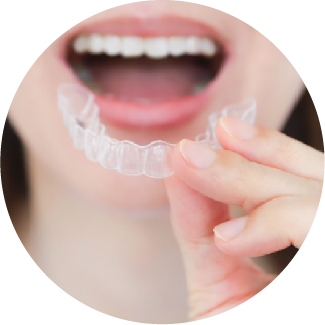 岩手県盛岡市の歯医者・インプラント歯科「高橋衛歯科医院」|ご自宅でのホワイトニングのイメージ